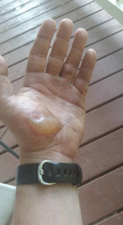 Burn.thumb.jpg.f088ce05045e8b30961450f24